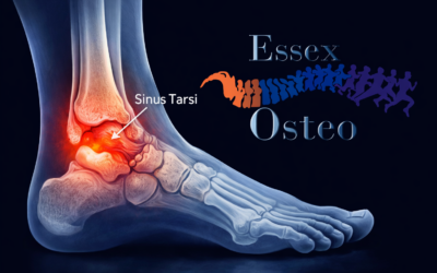 Sinus Tarsi Syndrome: Symptoms, Treatment and Exercises | Osteopath in Stanford-le-Hope