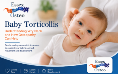 Baby Torticollis (Wry Neck): Understanding the Condition and How Osteopathy May Help