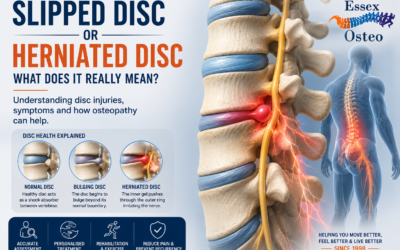 Slipped Disc or Herniated Disc – What Does It Mean?