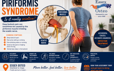 Piriformis Syndrome: Causes, Symptoms and Treatment