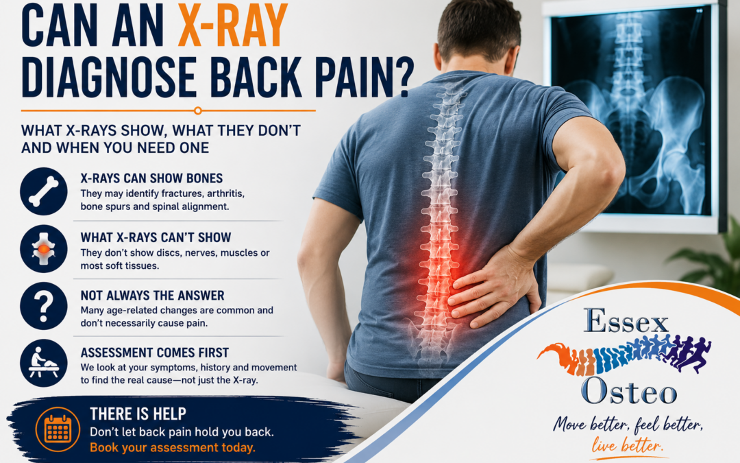 Can an X-Ray Diagnose Back Pain?
