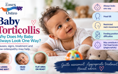 Baby Torticollis: Why Does My Baby Always Look One Way?